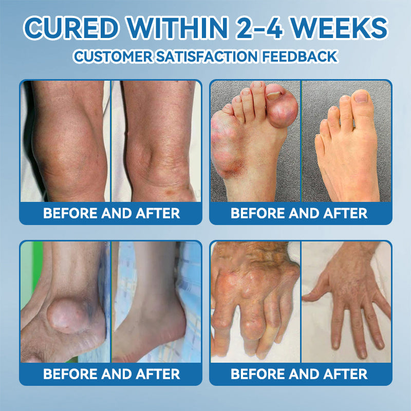 🇦🇺🌈𝐟𝐥𝐲𝐬𝐦𝐮𝐬® 𝐁𝐏𝐂-𝟏𝟓𝟕 𝐉𝐨𝐢𝐧𝐭 𝐇𝐞𝐚𝐥𝐢𝐧𝐠 𝐂𝐫𝐞𝐚𝐦🦴Treats Arthritis, Neuropathy, Rheumatism, Sports Injuries & More🏆