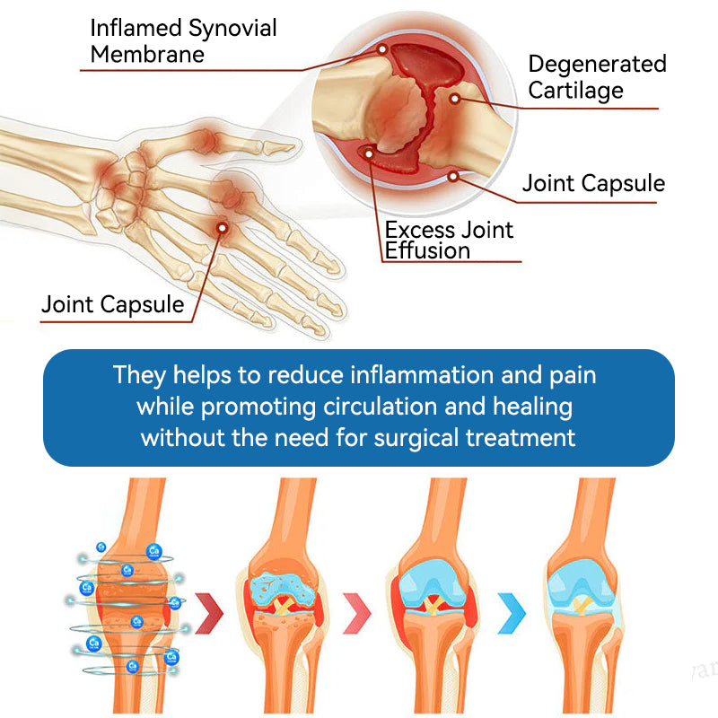 🇦🇺🌈𝐟𝐥𝐲𝐬𝐦𝐮𝐬® 𝐁𝐏𝐂-𝟏𝟓𝟕 𝐉𝐨𝐢𝐧𝐭 𝐇𝐞𝐚𝐥𝐢𝐧𝐠 𝐂𝐫𝐞𝐚𝐦🦴Treats Arthritis, Neuropathy, Rheumatism, Sports Injuries & More🏆