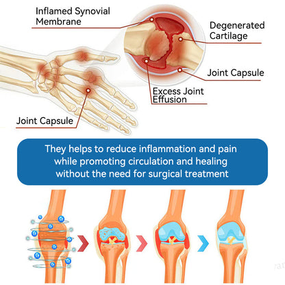 🇦🇺🌈𝐟𝐥𝐲𝐬𝐦𝐮𝐬® 𝐁𝐏𝐂-𝟏𝟓𝟕 𝐉𝐨𝐢𝐧𝐭 𝐇𝐞𝐚𝐥𝐢𝐧𝐠 𝐂𝐫𝐞𝐚𝐦🦴Treats Arthritis, Neuropathy, Rheumatism, Sports Injuries & More🏆