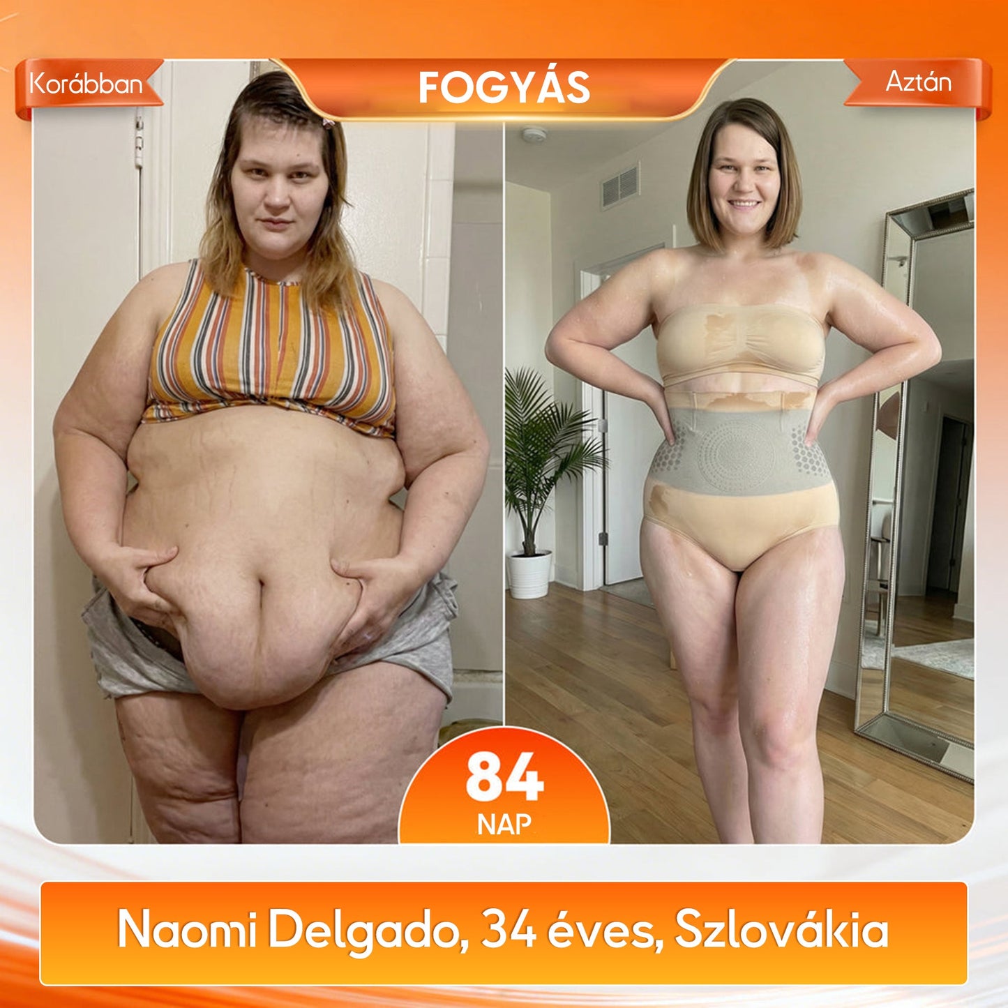 ✅✅A márka hivatalos üzlete | 🧑‍⚕️GFOUK® 2026 Moringa és berberin 4 az 1-ben mikrorészecskés alakformáló és zsírégető rövidnadrág