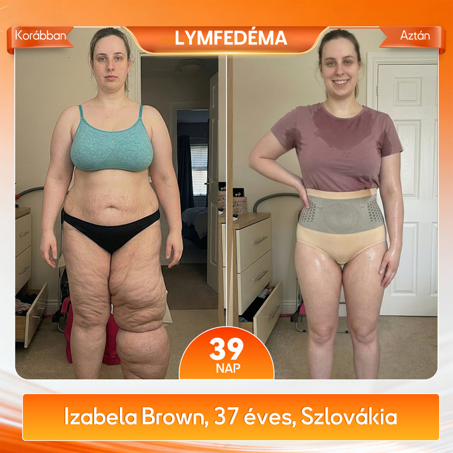✅✅A márka hivatalos üzlete | 🧑‍⚕️GFOUK® 2026 Moringa és berberin 4 az 1-ben mikrorészecskés alakformáló és zsírégető rövidnadrág