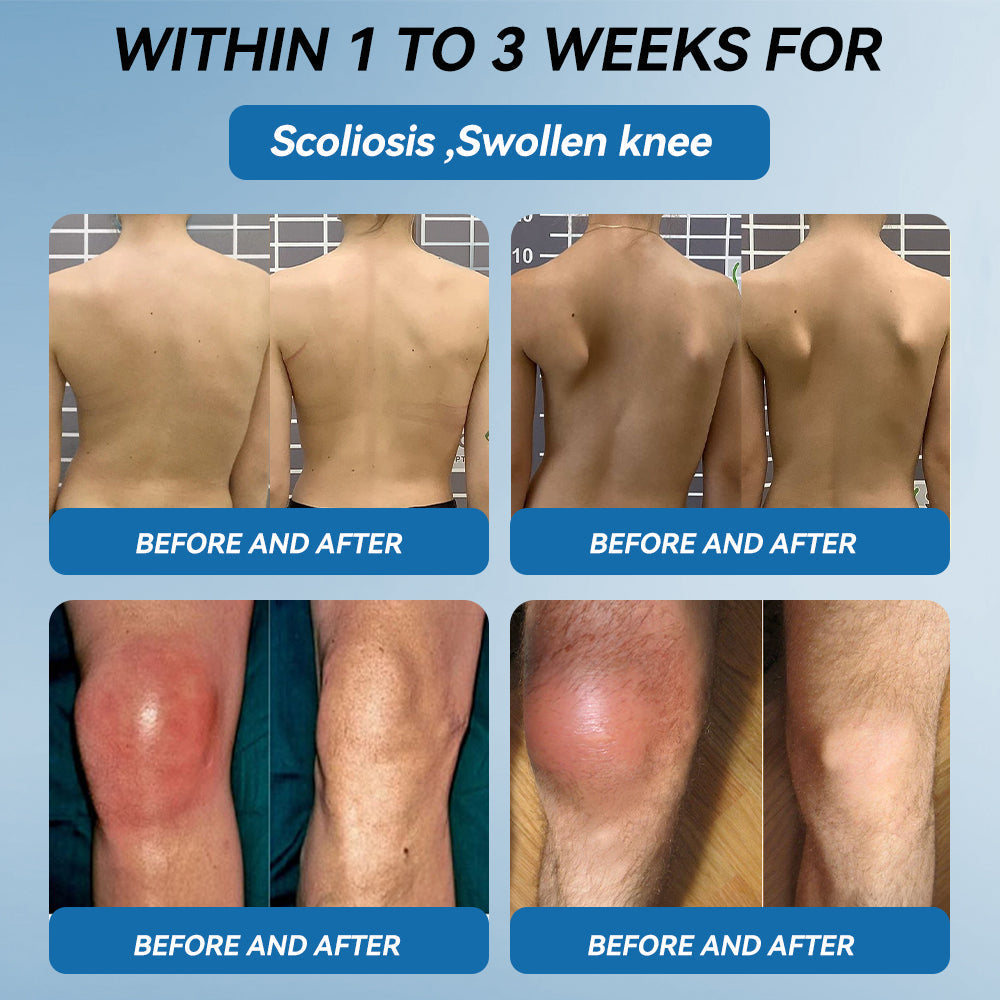 🇦🇺🌈𝐟𝐥𝐲𝐬𝐦𝐮𝐬® 𝐁𝐏𝐂-𝟏𝟓𝟕 𝐉𝐨𝐢𝐧𝐭 𝐇𝐞𝐚𝐥𝐢𝐧𝐠 𝐂𝐫𝐞𝐚𝐦🦴Treats Arthritis, Neuropathy, Rheumatism, Sports Injuries & More🏆