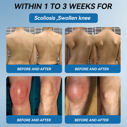 🇦🇺🌈𝐟𝐥𝐲𝐬𝐦𝐮𝐬® 𝐁𝐏𝐂-𝟏𝟓𝟕 𝐉𝐨𝐢𝐧𝐭 𝐇𝐞𝐚𝐥𝐢𝐧𝐠 𝐂𝐫𝐞𝐚𝐦🦴Treats Arthritis, Neuropathy, Rheumatism, Sports Injuries & More🏆