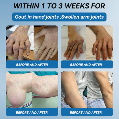 🇦🇺🌈𝐟𝐥𝐲𝐬𝐦𝐮𝐬® 𝐁𝐏𝐂-𝟏𝟓𝟕 𝐉𝐨𝐢𝐧𝐭 𝐇𝐞𝐚𝐥𝐢𝐧𝐠 𝐂𝐫𝐞𝐚𝐦🦴Treats Arthritis, Neuropathy, Rheumatism, Sports Injuries & More🏆