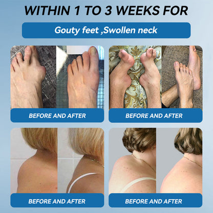 🇦🇺🌈𝐟𝐥𝐲𝐬𝐦𝐮𝐬® 𝐁𝐏𝐂-𝟏𝟓𝟕 𝐉𝐨𝐢𝐧𝐭 𝐇𝐞𝐚𝐥𝐢𝐧𝐠 𝐂𝐫𝐞𝐚𝐦🦴Treats Arthritis, Neuropathy, Rheumatism, Sports Injuries & More🏆